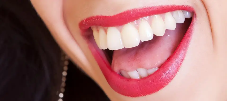close up of a smile showing very white teeth